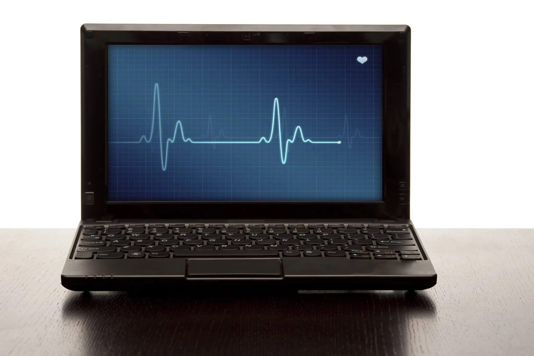 Open laptop computer with a pulse across the screen.